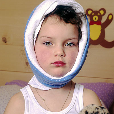 Foto:  Kinderkrankheiten von A-Z: Mumps