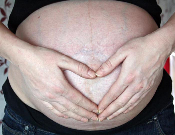 Illustration Angelika Samtleben-Frickmeier